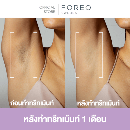 เครื่องกำจัดขน IPL FOREO PEACH 2 GO Lavender_7